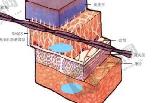 华 西医院整形外科价格表之胸部整形项目