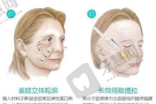 八大处刘暾博士整形价格，抗衰五官项目全揭秘，技术优口碑好可预约