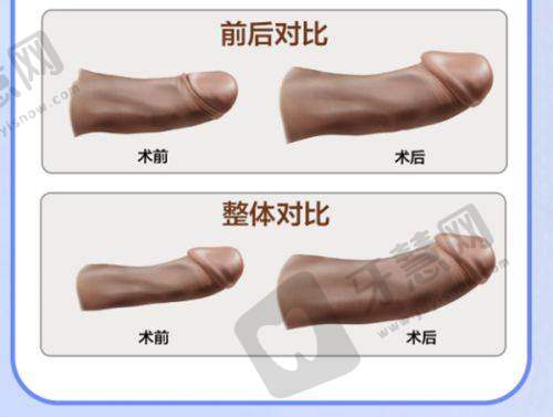 八大处整形价格一览表之深圳院区