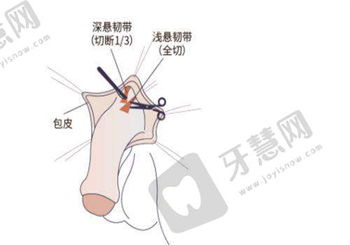 艺星整形价格表项目介绍 2025 - 价格影响因素及注意事项