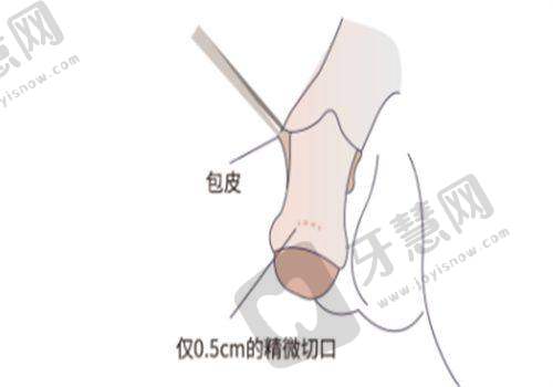 亲眼见证孙景波双眼皮实例：患者评价与口碑