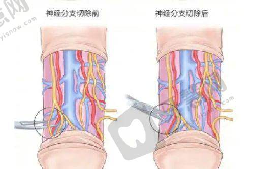 姐妹们都在问的重庆卢美均星眸眼双眼皮避坑之医生了解