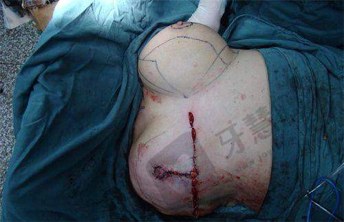 大连沙医生祛斑成效好吗?顾客评价与口碑反馈