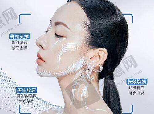 上海王衡健医生做双眼皮park法1W起之个性化设计亮点