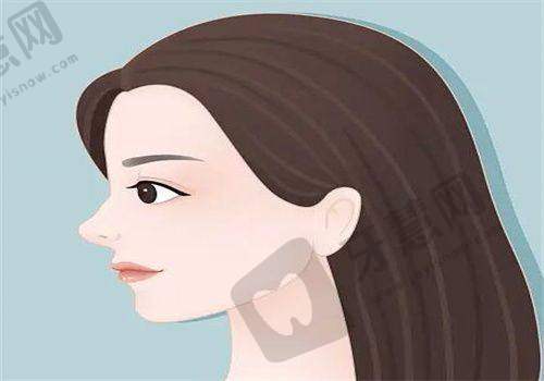 辽宁曙光王琳琳做切开双眼皮之价格情况