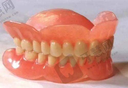 奉化区补牙项目价格