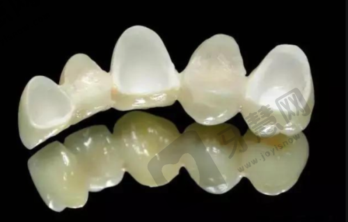 杭州艺星口腔医院收费标准之补牙项目