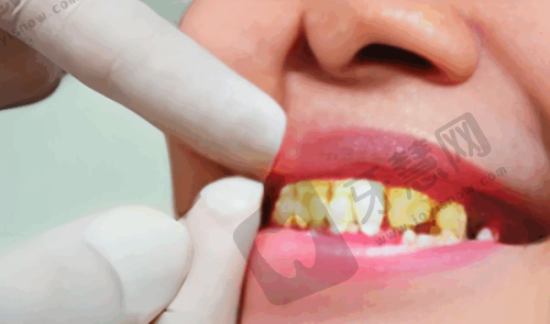 杭州艺星口腔医院收费标准揭秘，种植牙、矫正牙价格实惠口碑好