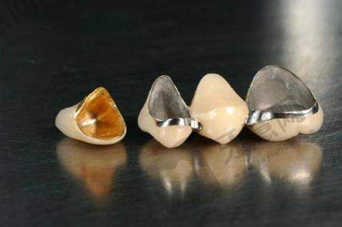 东莞牙状元口腔(优诺集团)收费贵吗?