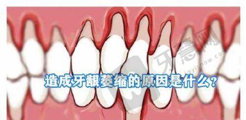 杭州艺星口腔医院收费标准之矫正牙项目