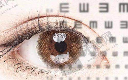 上虞眼科医院怎么样?