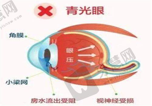 瑞金市人民医院眼科真人口碑评价怎么样？