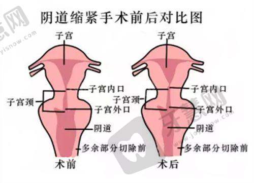 北京客来美舍医疗美容张冰洁修复双眼皮多少钱——口碑评价