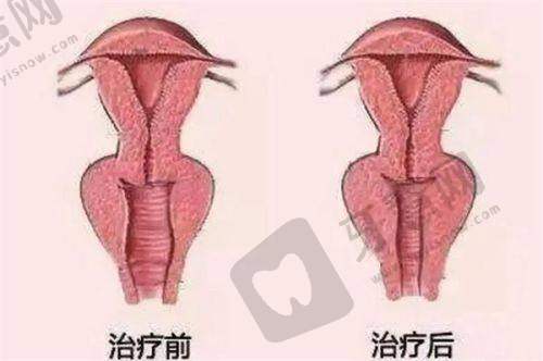 重庆军美整形医院价格表之胸部整形项目