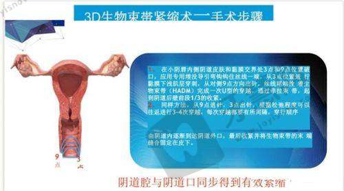 2025华美整形医院收费价格表