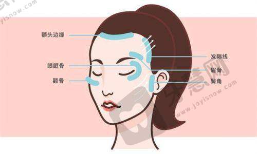 哈尔滨臻美整形价格表之技术优势