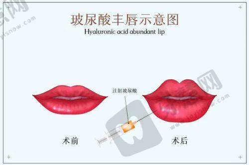 济南丽合整形价格查询：总结与建议