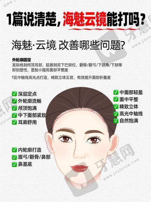 上海华美整形价格表之面部轮廓整形项目