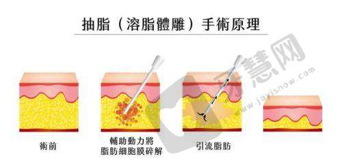 上海华美皮肤美容医院收费价目表剖析