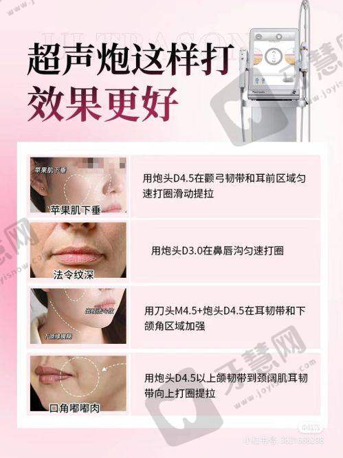 余文林医生做唇大概价格之唇腭裂二期修复价格