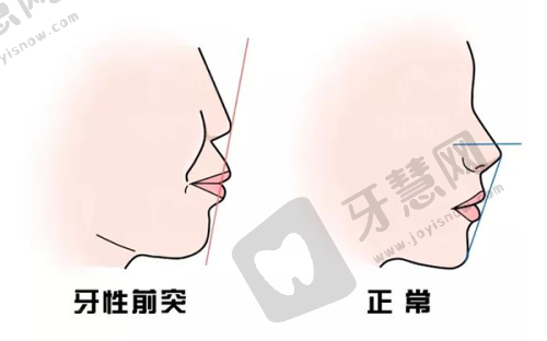 2025中信惠州医院整形价格表曝光，吸脂、轮廓手术价格亲民效果佳