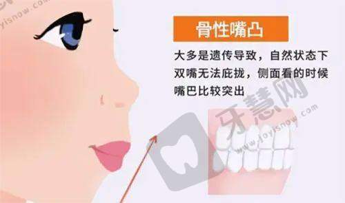2025中信惠州医院整形价格表之其他整形项目价格