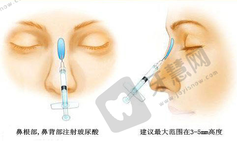 乌鲁木齐黎美整形医院做眼睛修复怎么样——收费情况分析