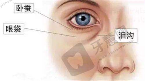 林潮割双眼皮价格是多少钱？眼部整形技艺精，近万例零失败口碑佳
