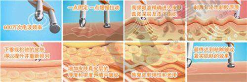 深圳阳光整形医院价格不贵又透明:私密整形与口腔项目收费标准