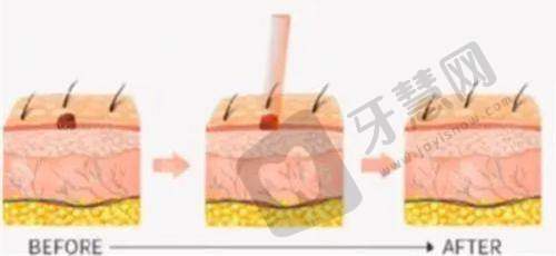 2025海口整形医院价格表