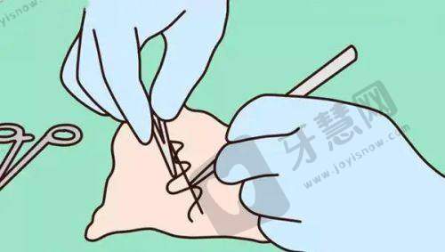 上海长海医院口腔科收费价格表/收费标准