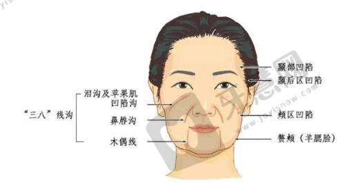 上海华美整形价格表之其他整形项目