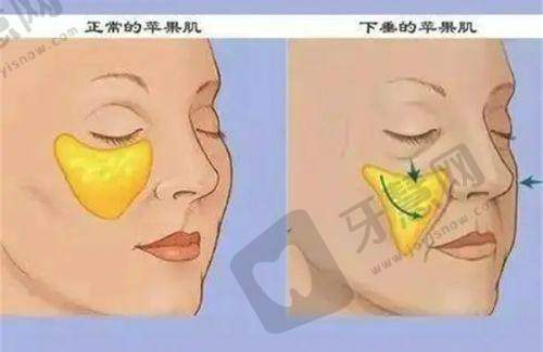 上海华美整形美容医院：多种异物取出技术保护