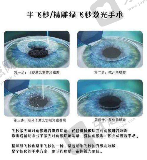 沈阳爱尔眼科医院(铁西门诊)正规吗？