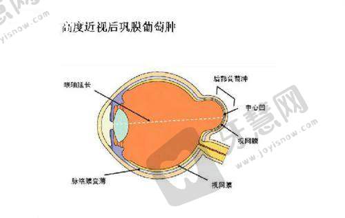 沈阳市红十字会医院眼科预约挂号