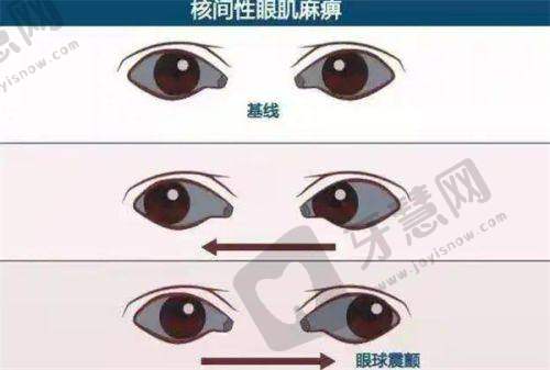 沈阳何氏眼科(于洪黄海门诊)正规吗？