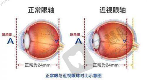 绍兴铭依眼科医院技术优势及特色服务