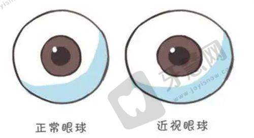 爱尔眼科医院到院预约的注意事项