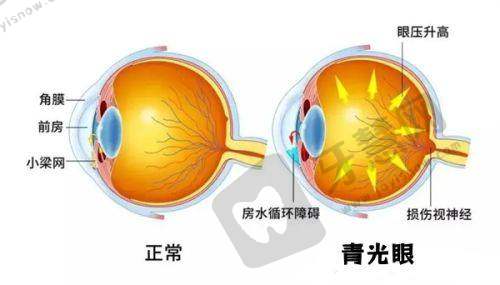 瑞金市人民医院眼科收费价格表/收费标准
