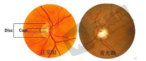 瑞金市人民医院眼科地址电话营业时间