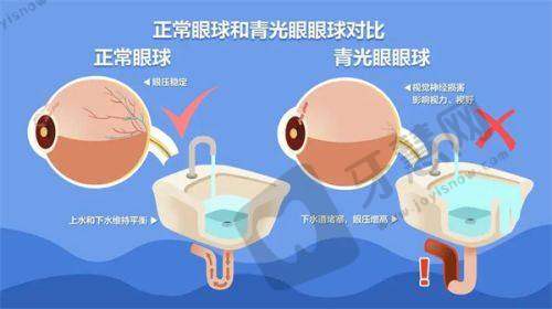 复旦大学附属中山医院眼科特色项目及技术优势