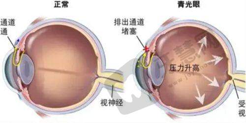 复旦大学附属中山医院眼科真人口碑评价怎么样？