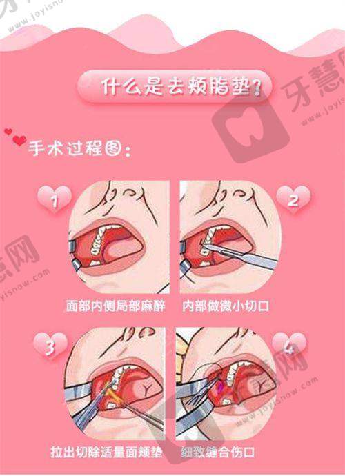 济南丽合整形价格查询：患者评价与口碑