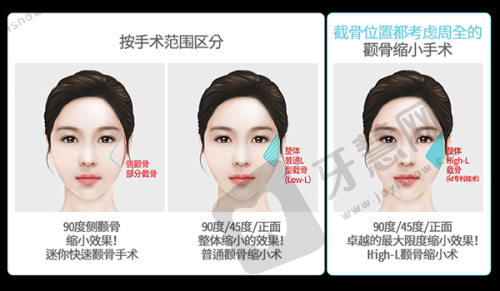 成都纯曦医美林靖医生眼整形价格之预约与面诊