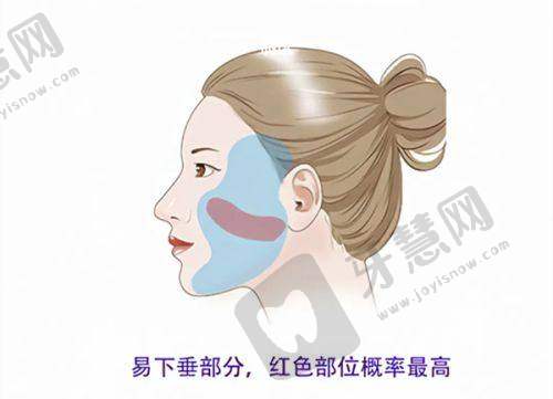 北京星范医疗美容割双眼皮怎么样