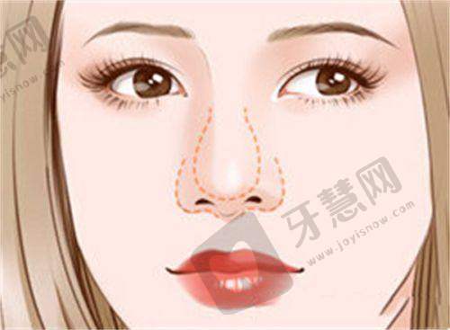 武汉美立方整形价格表之胸部整形项目