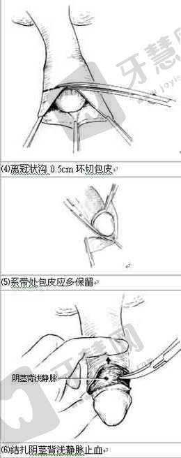 复旦大学附属妇产科医院男科真人口碑评价怎么样？