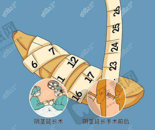 复旦大学附属妇产科医院男科特色项目及技术优势