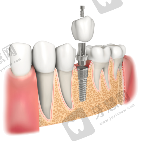 江苏徐州牙知道口腔连锁口碑如何