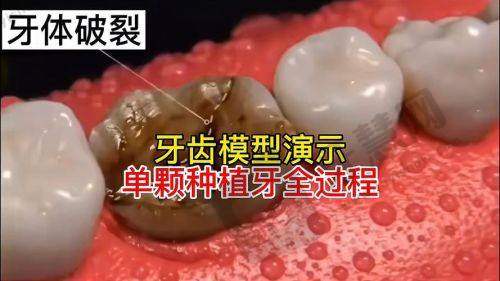 东莞好佰年口腔医院口碑如何